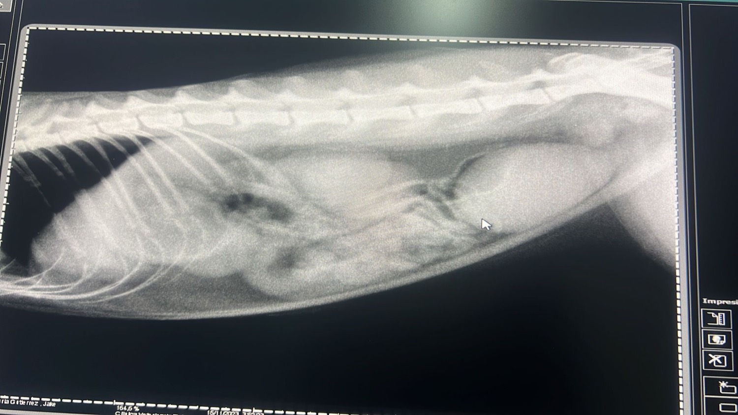 Radiografía de tórax y abdomen